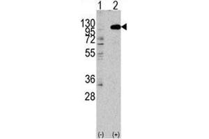 Western blot analysis of FGFR2 antibody and 293 lysate transiently transfected with the human gene. (FGFR2 Antikörper  (AA 794-821))
