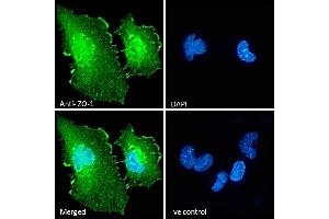 Immunofluorescence (IF) image for anti-Tight Junction Protein 1 (TJP1) (Internal Region) antibody (ABIN570961)