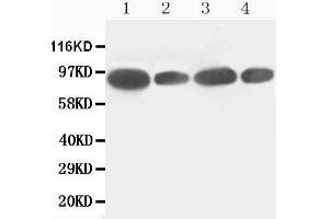 Western Blotting (WB) image for anti-Feline Sarcoma Oncogene (FES) (AA 808-822), (C-Term) antibody (ABIN3043015)