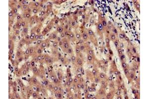 Immunohistochemistry of paraffin-embedded human liver tissue using ABIN7174495 at dilution of 1:100 (UBE2V2 Antikörper  (AA 2-145))