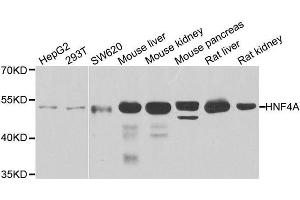 Western blot analysis of extracts of various cell lines, using HNF4A antibody. (HNF4A Antikörper  (AA 200-300))