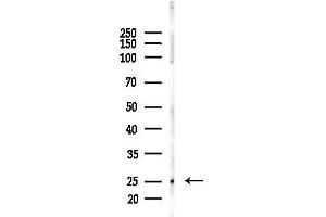anti-Claudin 10 (CLDN10) (C-Term) antibody