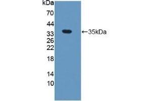 Detection of Recombinant NEIL1, Human using Polyclonal Antibody to Nei Endonuclease VIII Like Protein 1 (NEIL1) (NEIL1 Antikörper  (AA 43-314))