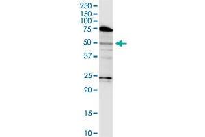 LASS3 monoclonal antibody (M02), clone 6C12. (LASS3 Antikörper  (AA 57-134))