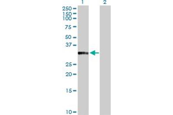 Annexin a10 Antikörper  (AA 1-324)