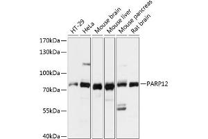 Western blot analysis of extracts of various cell lines, using P antibody (ABIN7269443) at 1:3000 dilution. (PARP12 Antikörper  (AA 462-701))