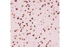 Anti-ATF2 Picoband antibody,  IHC(P): Mouse Brain Tissue (ATF2 Antikörper  (AA 93-450))