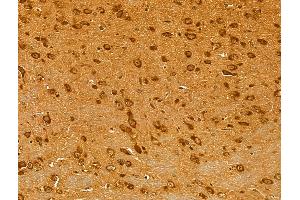 ABIN6262116 and ABIN6273047 at 1/100 staining Mouse brain tissue by IHC-P. (GSTA4 Antikörper  (N-Term))