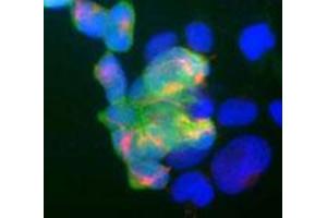 Shows human embryonic kidney cell line 293 stained with mouse monoclonal to UCHL1 monoclonal antibody, clone BH7  (green) and rabbit antibody to neurofilament NF-M (red).