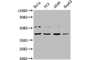 Western Blot Positive WB detected in: Hela whole cell lysate, PC-3 whole cell lysate, A549 whole cell lysate, HepG2 whole cell lysate All lanes: DUX4 antibody at 1:2000 Secondary Goat polyclonal to rabbit IgG at 1/50000 dilution Predicted band size: 45 kDa Observed band size: 45 kDa (DUX4 Antikörper  (AA 217-402))
