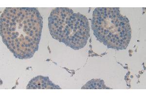 Detection of MMP3 in Rat Testis Tissue using Polyclonal Antibody to Matrix Metalloproteinase 3 (MMP3) (MMP3 Antikörper  (AA 278-450))