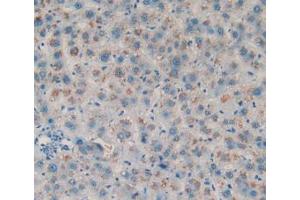 DAB staining on IHC-P; Samples: Human Liver Tissue (Amphiregulin Antikörper  (AA 20-100))