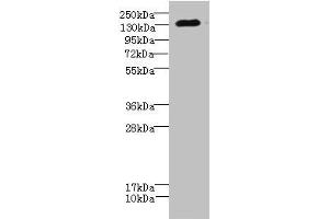Western blot All lanes: CACNA2D2 antibody IgG at 4. (CACNA2D2 Antikörper  (AA 20-200))