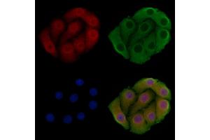 ABIN6259157 and ABIN6275548 staining Hela cells by IF/ICC.