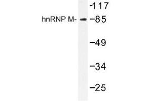 Image no. 1 for anti-Heterogeneous Nuclear Ribonucleoprotein M (HNRNPM) antibody (ABIN317716) (HNRNPM Antikörper)