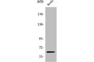 Western Blot analysis of HuvEc cells using ZNF329 Polyclonal Antibody (ZNF329 Antikörper  (Internal Region))