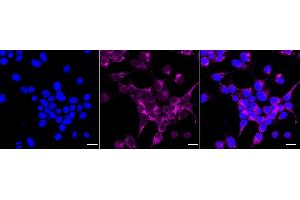Immunocytochemical staining of HeLa cells with NSDHL antibody (ABIN7799538), 1:1,000).