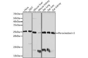 Western blot analysis of extracts of various cell lines, using Peroxiredoxin 6 Rabbit mAb (ABIN7269240) at 1:1000 dilution. (Peroxiredoxin 6 Antikörper)