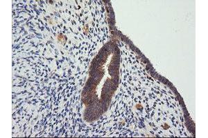 Image no. 6 for anti-Cancer/testis Antigen 1B (CTAG1B) antibody (ABIN1499889) (CTAG1B Antikörper)