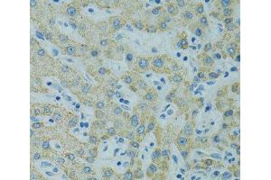 Immunohistochemistry of paraffin-embedded Human liver using STX1A Polyclonal Antibody at dilution of 1:100 (40x lens). (STX1A Antikörper)