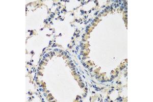 Immunohistochemistry of paraffin-embedded mouse lung using BMP2 antibody. (BMP2 Antikörper  (AA 283-396))