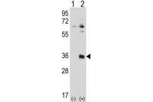 Western blot analysis of TSSK6 (arrow) using rabbit polyclonal TSSK6 Antibody (N-term) . (TSSK6 Antikörper  (N-Term))