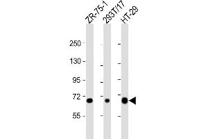 All lanes : Anti-SLC28A1 Antibody (Center) at 1:2000 dilution Lane 1: ZR-75-1 whole cell lysate Lane 2: 293T/17 whole cell lysate Lane 3: HT-29 whole cell lysate Lysates/proteins at 20 μg per lane. (SLC28A1 Antikörper  (AA 381-409))