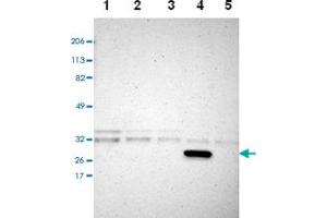 Western blot analysis of Lane 1: RT-4, Lane 2: U-251 MG, Lane 3: A-431, Lane 4: Liver, Lane 5: Tonsil with CREM polyclonal antibody. (CREM Antikörper)