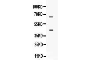 Western blot analysis of CD33 expression in SKOV3 whole cell lysates ( Lane 1). (CD33 Antikörper  (AA 18-259))