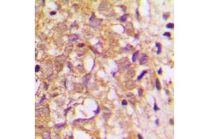 Immunohistochemistry (IHC) image for anti-Metalloproteinase Inhibitor 2 (TIMP2) (Center) antibody (ABIN7297146)