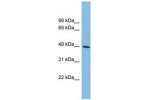 Image no. 1 for anti-Melanoma Antigen Family B, 4 (MAGEB4) (AA 35-84) antibody (ABIN6745113)