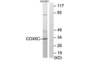Western blot analysis of extracts from HuvEc cells, using COX6C Antibody. (COX6C Antikörper  (AA 11-60))