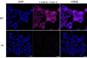 Immunocytochemical staining of HeLa cells using Creatine kinase B antibody (ABIN7798163), 1:1,000), Top panel: wild-type (WT), Bottom panal: Creatine kinase B shRNA knockdown (KD). (Rekombinanter CKB Antikörper)