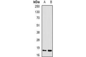 Western blot analysis of GADD45 alpha expression in mouse liver (A), mouse kidney (B) whole cell lysates. (GADD45A Antikörper)