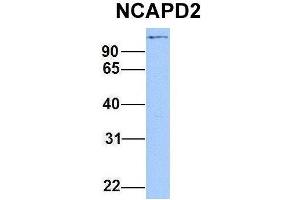Host:  Rabbit  Target Name:  NCAPD2  Sample Type:  Hela  Antibody Dilution:  1. (NCAPD2 Antikörper  (C-Term))