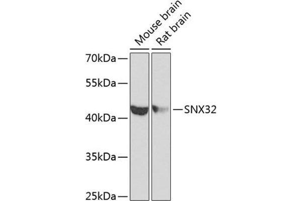 SNX32 Antikörper  (AA 144-403)