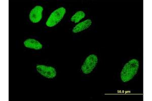 Immunofluorescence of monoclonal antibody to SRF on HeLa cell. (SRF Antikörper  (AA 406-508))