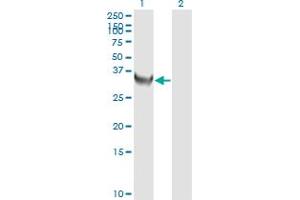 Western Blotting (WB) image for anti-Thymidylate Synthetase (TYMS) (AA 111-210) antibody (ABIN563306)