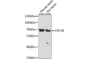 Western blot analysis of extracts of various cell lines, using CDY1B antibody (ABIN7266365) at 1:1000 dilution. (CDY1B Antikörper  (AA 60-320))