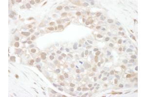Immunohistochemistry (IHC) image for anti-Cyclin T1 (CCNT1) (AA 250-300) antibody (ABIN7453622)