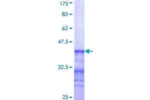 BAT3 Protein (AA 1033-1132) (GST tag)