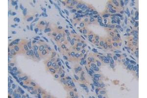 Used in DAB staining on fromalin fixed paraffin- embedded lung tissue