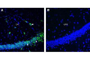 Expression of SLC3A2 (CD98) in mouse hippocampusImmunohistochemical staining of perfusion-fixed frozen mouse brain sections with Anti-SLC3A2 (CD98) (extracellular) Antibody (ABIN7581980), (1:300), followed by goat anti-rabbit-AlexaFluor-488.