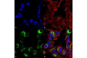 Immunocytochemistry/Immunofluorescence analysis using Rabbit Anti-AMBRA1 Polyclonal Antibody . (AMBRA1 Antikörper  (AA 200-300) (Atto 594))
