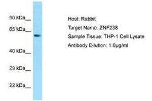 Image no. 1 for anti-Zinc Finger Protein 238 (ZNF238) (AA 143-192) antibody (ABIN6749839) (ZNF238 Antikörper  (AA 143-192))