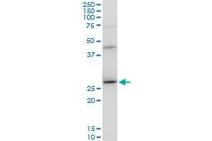 Western Blotting (WB) image for anti-DnaJ (Hsp40) Homolog, Subfamily B, Member 6 (DNAJB6) (AA 1-241) antibody (ABIN564338)