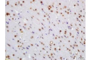 Formalin-fixed and paraffin embedded rat brain labeled with Rabbit Anti-WRB Polyclonal Antibody, Unconjugated (ABIN1387386) at 1:200 followed by conjugation to the secondary antibody and DAB staining