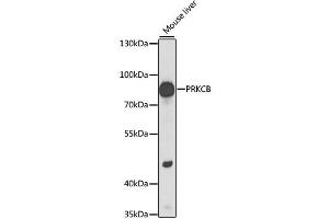 Western blot analysis of extracts of mouse liver, using PRKCB antibody. (PKC beta Antikörper)