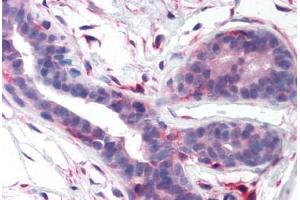 Immunohistochemistry (Paraffin-embedded Sections) (IHC (p)) image for anti-PTK2 Protein tyrosine Kinase 2 (PTK2) (Kinase Domain) antibody (ABIN213412)