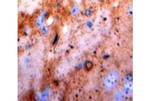 IHC-P analysis of Brain tissue, with DAB staining. (Pkc beta 1 Antikörper  (AA 342-600))